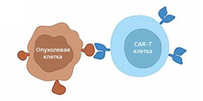 CAR-T терапия онкогематологических заболеваний
